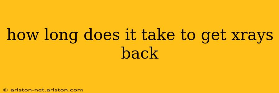 how long does it take to get xrays back