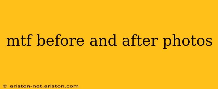 mtf before and after photos