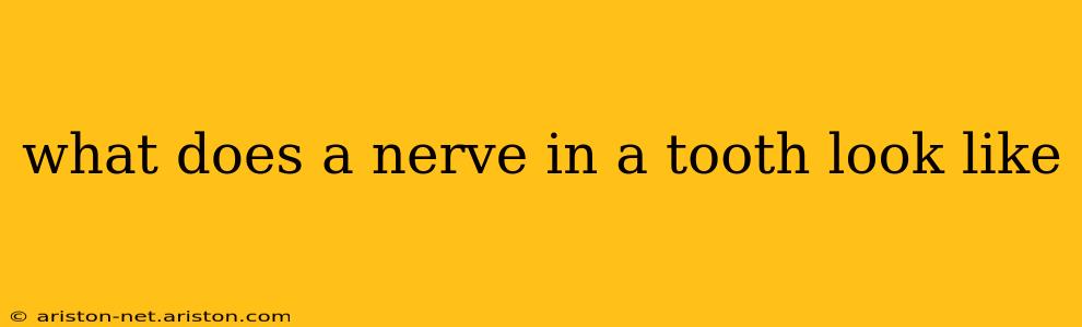what does a nerve in a tooth look like